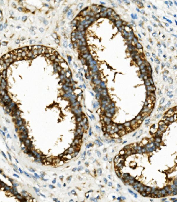 2 - Anti-Hexokinase 1/HK1 Antibody Picoband™ (monoclonal, 4B7) ABO14940
