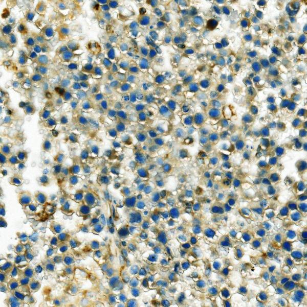 2 - Anti-Hexokinase 1/HK1 Antibody Picoband™ (monoclonal, 4B7) ABO14940