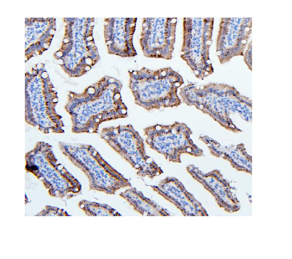 2 - Anti-Hexokinase 1/HK1 Antibody Picoband™ (monoclonal, 4B7) ABO14940