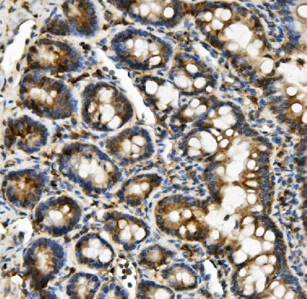 2 - Anti-Hexokinase 1/HK1 Antibody Picoband™ (monoclonal, 4B7) ABO14940