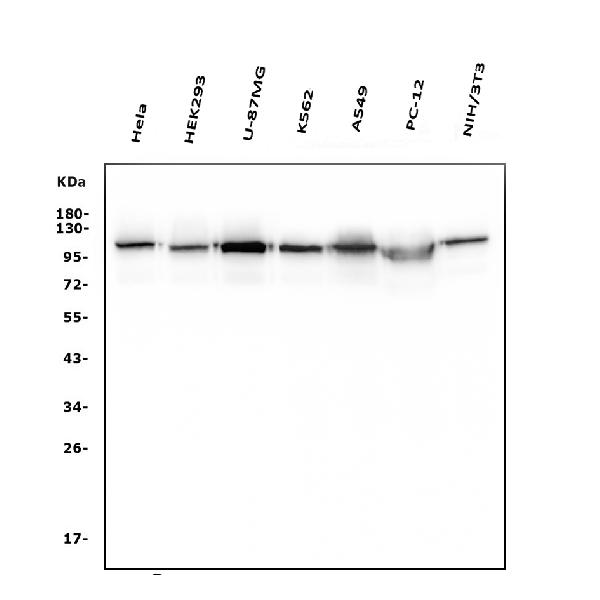 1 - Anti-Hexokinase 1/HK1 Antibody Picoband™ (monoclonal, 4B7) ABO14940