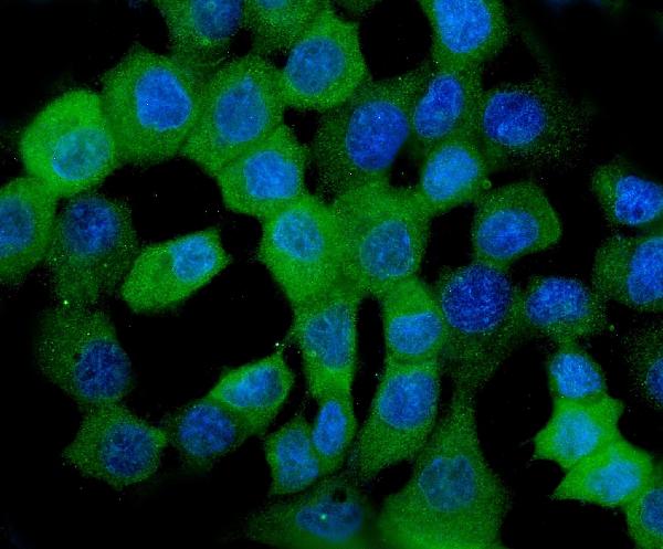 3 - Anti-HSPB8/Hsp22 Antibody Picoband™ (monoclonal, 7D8) ABO14941