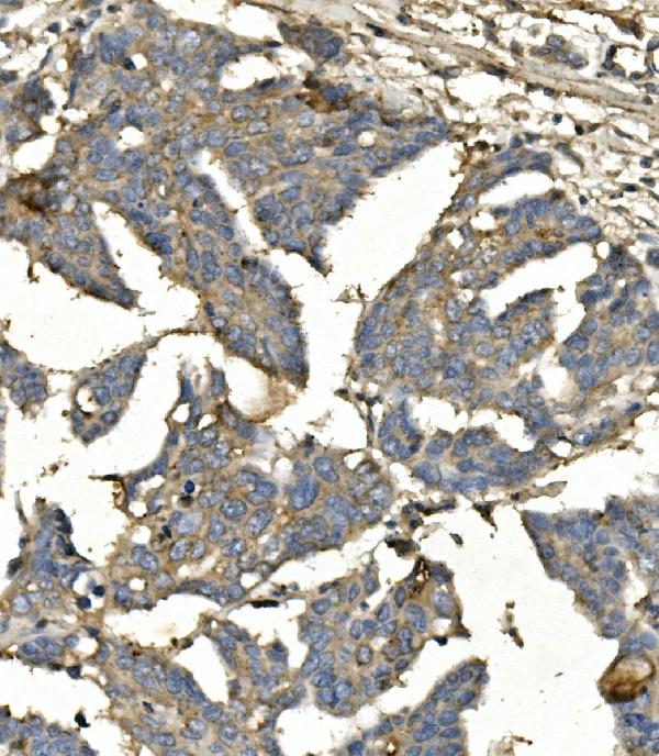 2 - Anti-BubR1/BUB1B Antibody Picoband™ (monoclonal, 5I7) ABO14942