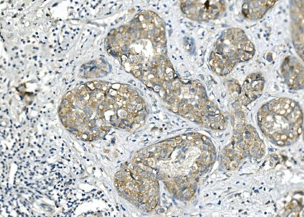 2 - Anti-BubR1/BUB1B Antibody Picoband™ (monoclonal, 5I7) ABO14942