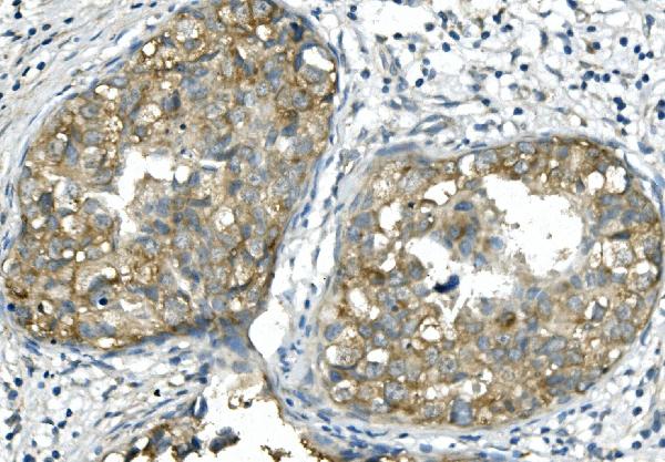 2 - Anti-BubR1/BUB1B Antibody Picoband™ (monoclonal, 5I7) ABO14942