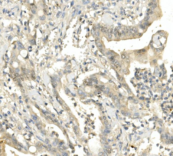 2 - Anti-BubR1/BUB1B Antibody Picoband™ (monoclonal, 5I7) ABO14942