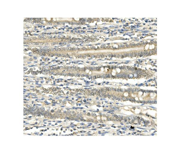 2 - Anti-BubR1/BUB1B Antibody Picoband™ (monoclonal, 8B3) ABO14943