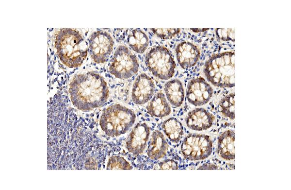 2 - Anti-BubR1/BUB1B Antibody Picoband™ (monoclonal, 8B3) ABO14943