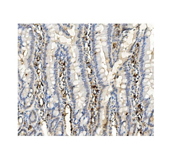 2 - Anti-BubR1/BUB1B Antibody Picoband™ (monoclonal, 8B3) ABO14943