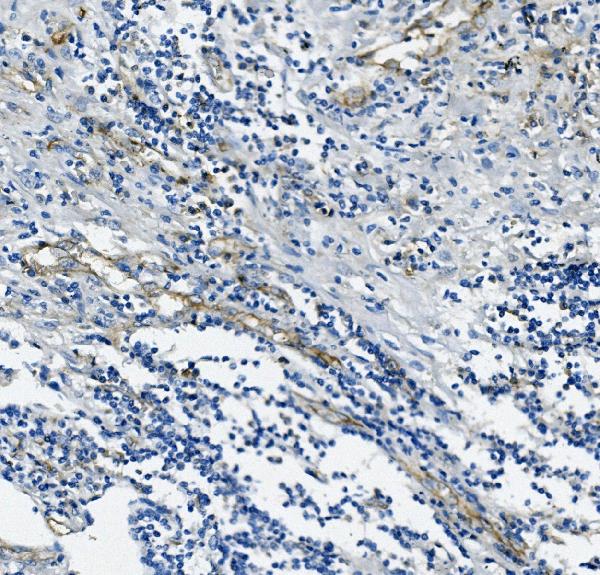 2 - Anti-CD31/PECAM1 Antibody Picoband™ (monoclonal, 2D4) ABO14944
