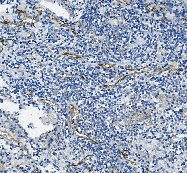 2 - Anti-CD31/PECAM1 Antibody Picoband™ (monoclonal, 2D4) ABO14944