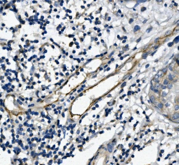 2 - Anti-CD31/PECAM1 Antibody Picoband™ (monoclonal, 2D4) ABO14944