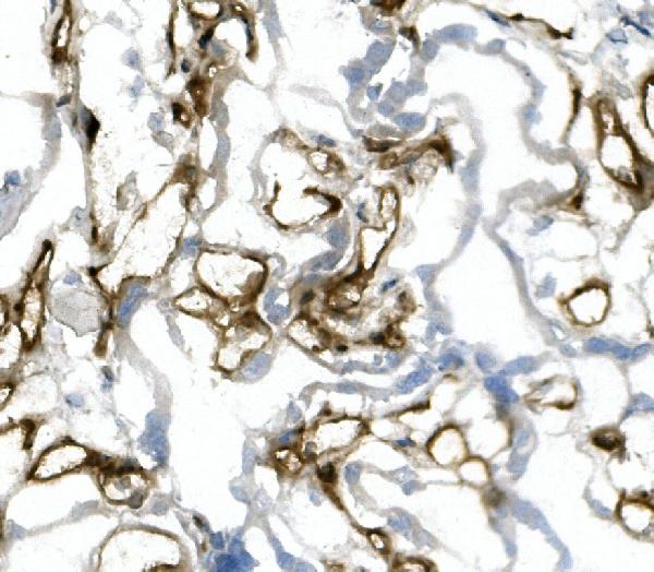 2 - Anti-CD31/PECAM1 Antibody Picoband™ (monoclonal, 2D4) ABO14944
