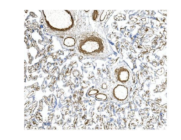 2 - Anti-CD146/MCAM Antibody Picoband™ (monoclonal, 4C12) ABO14945