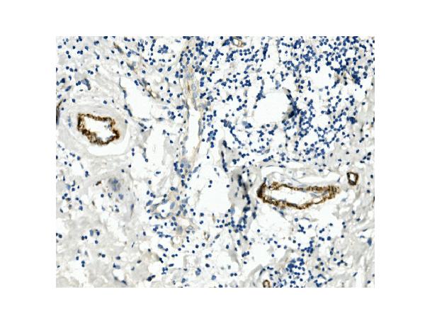 2 - Anti-CD146/MCAM Antibody Picoband™ (monoclonal, 4C12) ABO14945