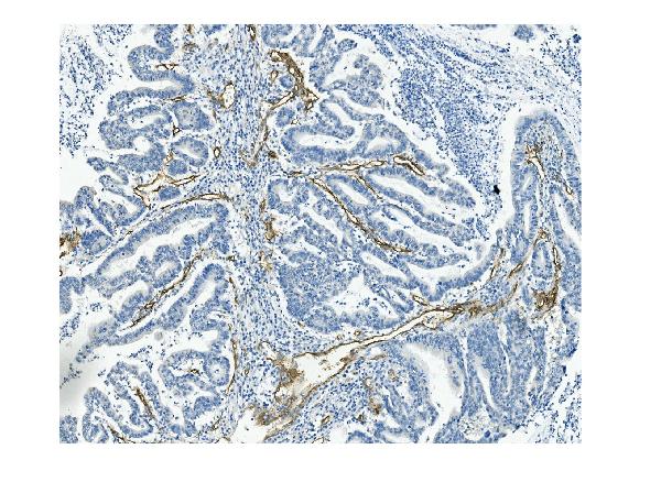 2 - Anti-CD146/MCAM Antibody Picoband™ (monoclonal, 4C12) ABO14945