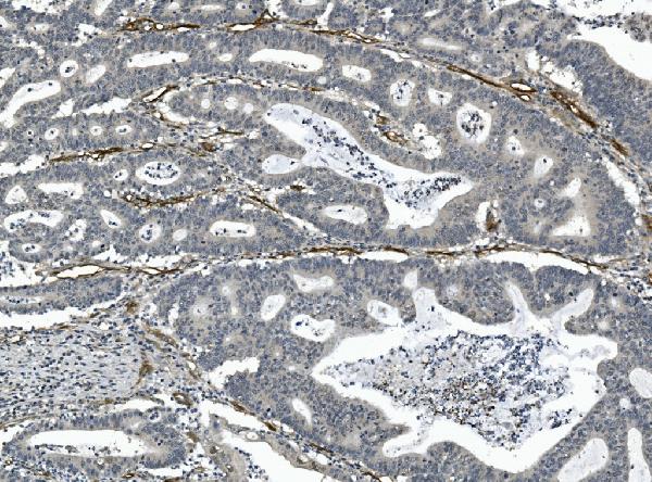 2 - Anti-CD146/MCAM Antibody Picoband™ (monoclonal, 2H12) ABO14946