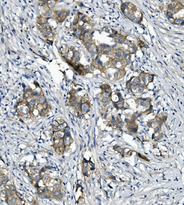 2 - Anti-alpha 1 Catenin/CTNNA1 Antibody Picoband™ (monoclonal, 10I2) ABO14947