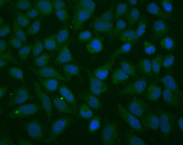 3 - Anti-Thioredoxin 2/TXN2 Antibody Picoband™ (monoclonal, 7B5) ABO14948