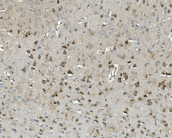 2 - Anti-Thioredoxin 2/TXN2 Antibody Picoband™ (monoclonal, 7B5) ABO14948