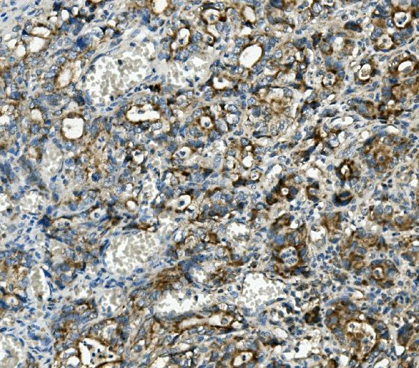 2 - Anti-Thioredoxin 2/TXN2 Antibody Picoband™ (monoclonal, 4H3) ABO14949
