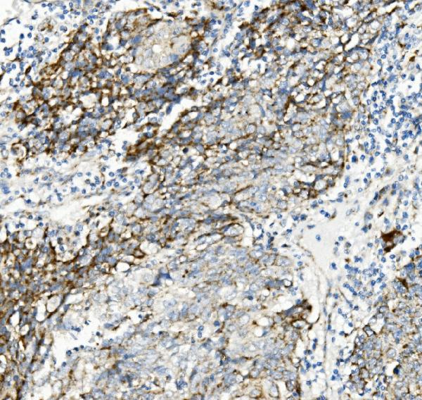 2 - Anti-Thioredoxin 2/TXN2 Antibody Picoband™ (monoclonal, 4H3) ABO14949