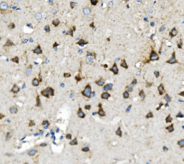 2 - Anti-Thioredoxin 2/TXN2 Antibody Picoband™ (monoclonal, 4H3) ABO14949