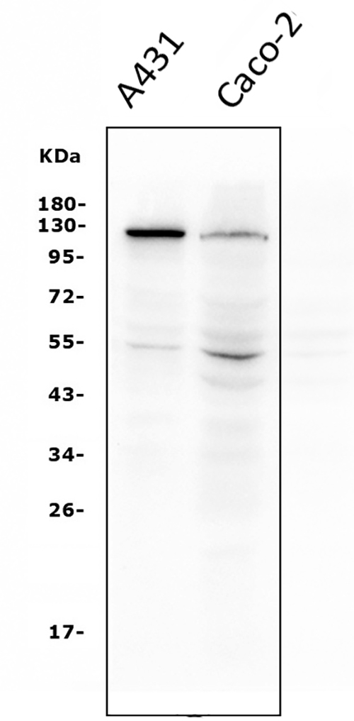 1 - Anti-P-Cadherin-3 CDH3-Antibody Picoband™ (monoclonal, 3C9) ABO14950