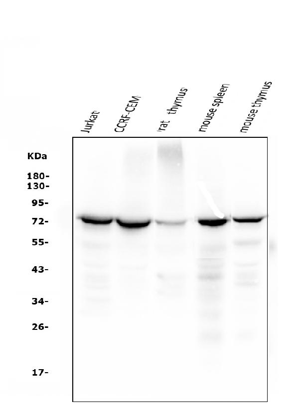 1 - Anti-ZAP70 Antibody Picoband™ (monoclonal, 9D5) ABO14951