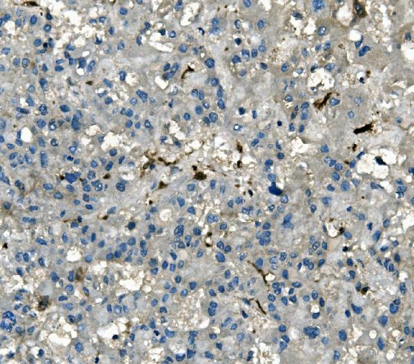 2 - Anti-AKR1D1 Antibody Picoband™ (monoclonal, 6I4) ABO14952