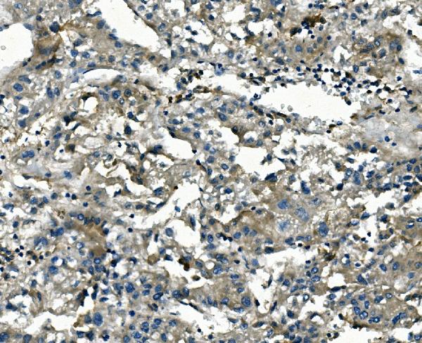2 - Anti-AKR1D1 Antibody Picoband™ (monoclonal, 6I4) ABO14952