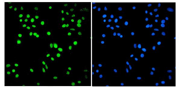 3 - Anti-SMARCA2/BRM Antibody Picoband™ (monoclonal, 3G3) ABO14954