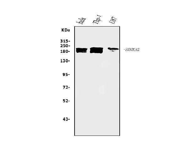 1 - Anti-SMARCA2/BRM Antibody Picoband™ (monoclonal, 3G3) ABO14954