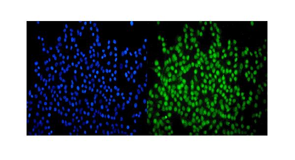 3 - Anti-SMARCA2/BRM Antibody Picoband™ (monoclonal, 4E8) ABO14955