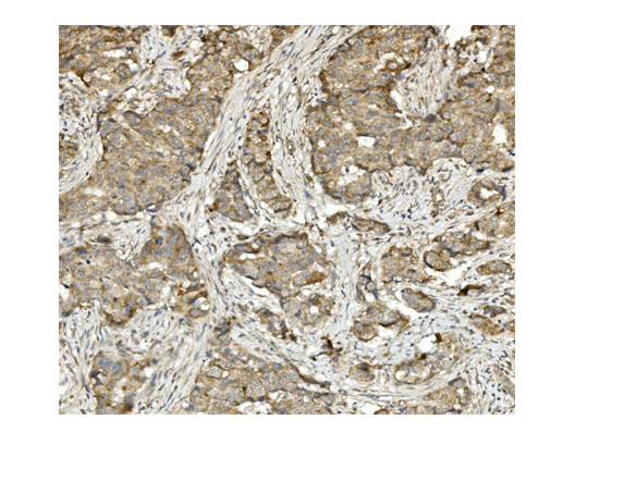 2 - Anti-Methylmalonyl Coenzyme A mutase Antibody Picoband™ (monoclonal, 2D6) ABO14958