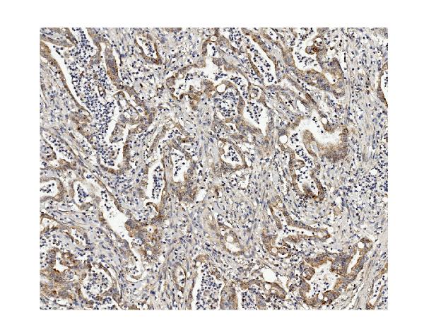 2 - Anti-Methylmalonyl Coenzyme A mutase Antibody Picoband™ (monoclonal, 2D6) ABO14958