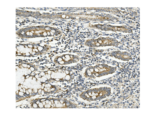 2 - Anti-Methylmalonyl Coenzyme A mutase Antibody Picoband™ (monoclonal, 2D6) ABO14958
