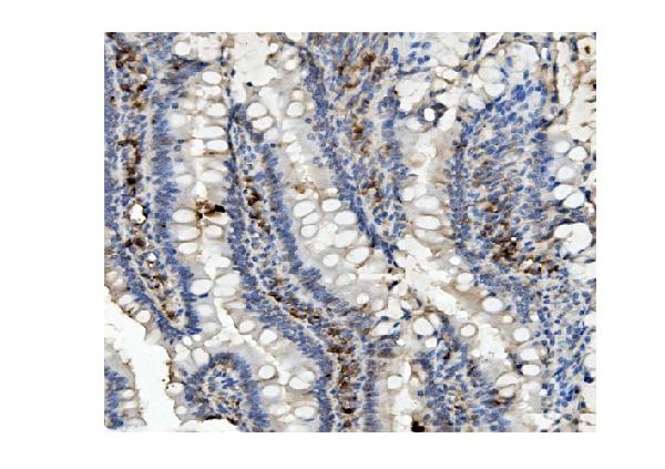 2 - Anti-Methylmalonyl Coenzyme A mutase Antibody Picoband™ (monoclonal, 2D6) ABO14958