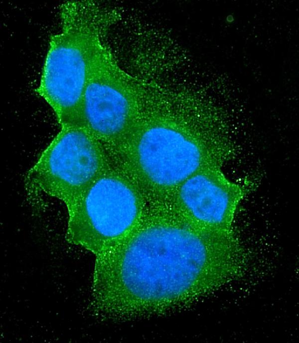 3 - Anti-Bid Antibody Picoband™ (monoclonal, 10F4) ABO14959