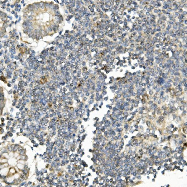 2 - Anti-Bid Antibody Picoband™ (monoclonal, 10F4) ABO14959