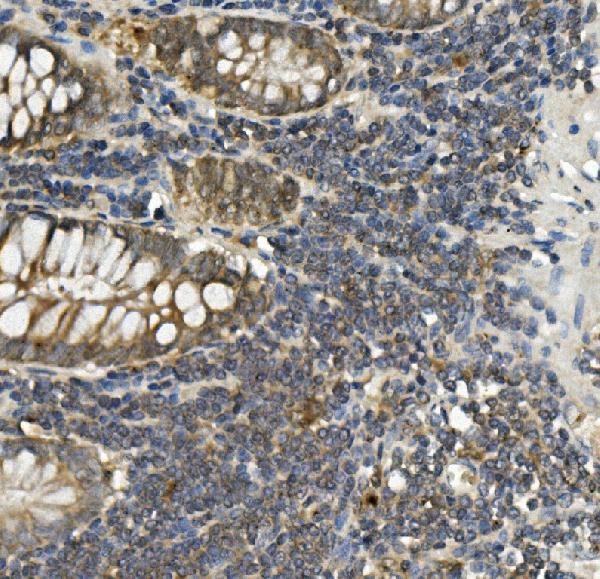 2 - Anti-Bid Antibody Picoband™ (monoclonal, 10F4) ABO14959