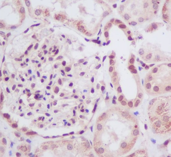2 - Anti-UBE2I/Ubc9 Rabbit Monoclonal Antibody ABO14960