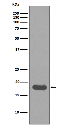 1 - Anti-UBE2I/Ubc9 Rabbit Monoclonal Antibody ABO14960