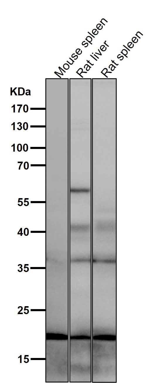 1 - Anti-UBE2I/Ubc9 Rabbit Monoclonal Antibody ABO14960