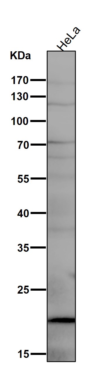 1 - Anti-UBE2I/Ubc9 Rabbit Monoclonal Antibody ABO14960