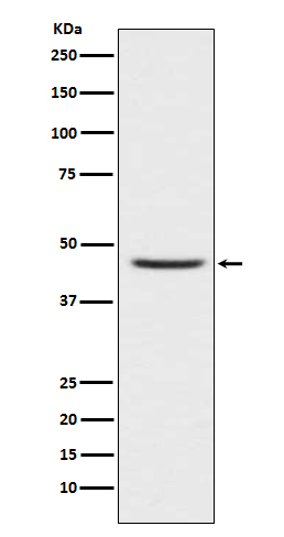 1 - Anti-CCR8 Rabbit Monoclonal Antibody ABO14961