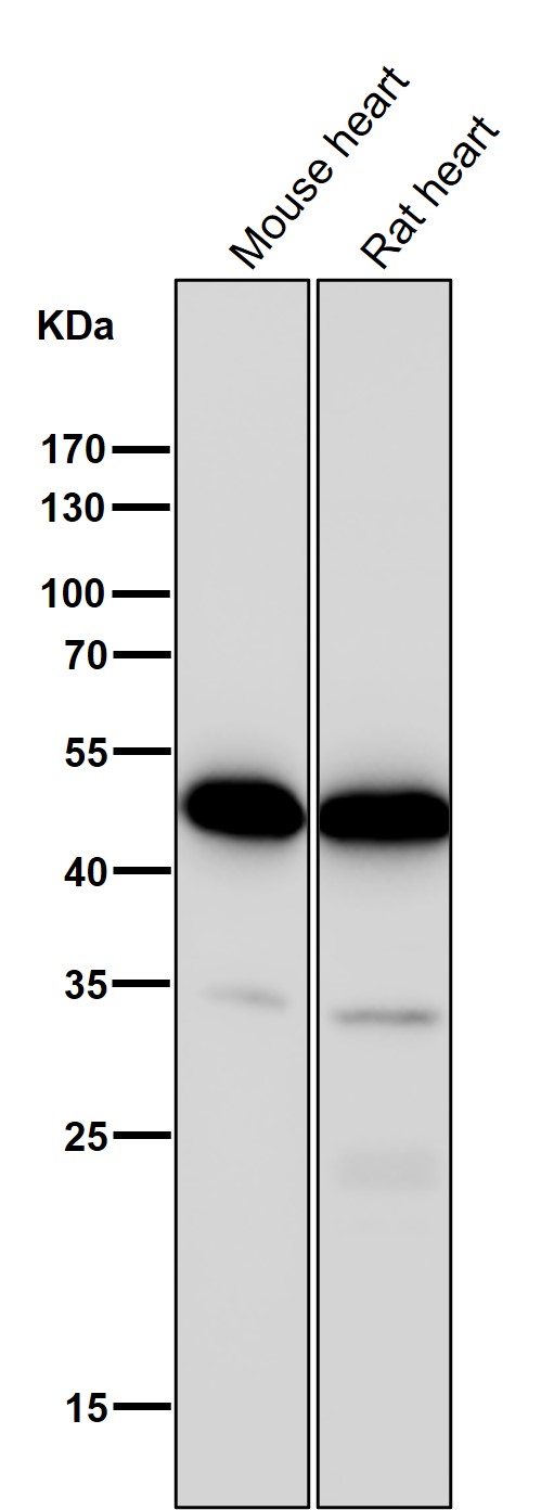 1 - Anti-CCR8 Rabbit Monoclonal Antibody ABO14961
