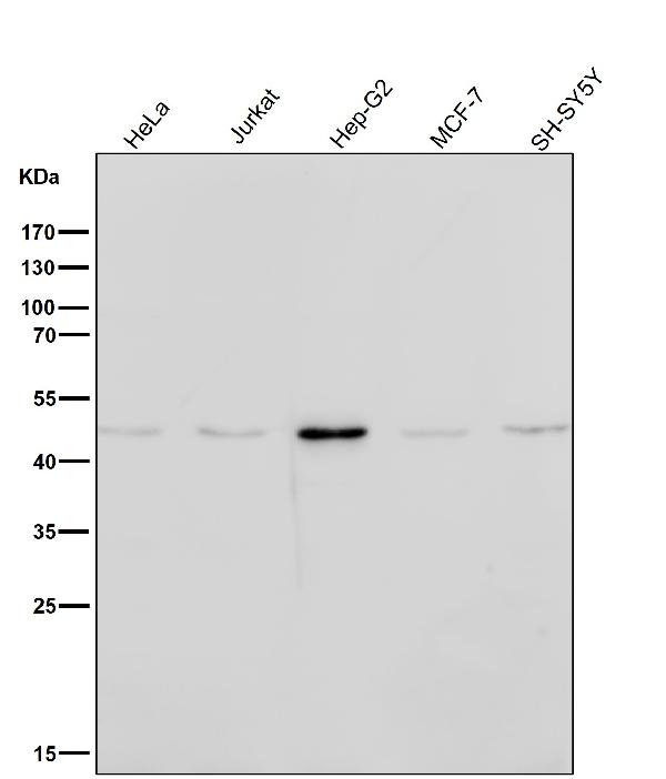 1 - Anti-CCR8 Rabbit Monoclonal Antibody ABO14961