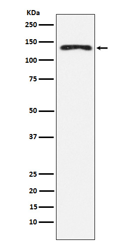 1 - Anti-NEDD4 Rabbit Monoclonal Antibody ABO14962