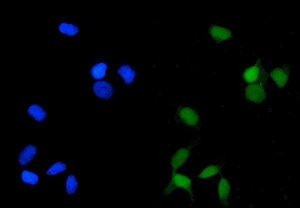 3 - Anti-PP2A-alpha/PPP2CA Antibody Picoband™ (monoclonal, 3B6) ABO14963